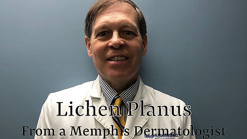 Dermatology Minute - Lichen Planus